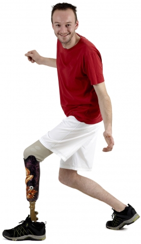 Orthotic and Prosthetic Services